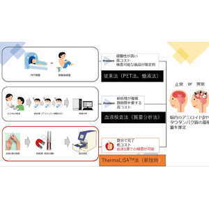 血液1滴で認知症リスクを測定 「ThermaLISA（サーマライザ）法リスク測定キット」メールマガジン配信開始