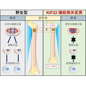 関節弛緩を伴う脊椎骨端骨幹端異形成症2型の責任遺伝子KIF22の機能を解明　～難病の病因解明に一歩前進～