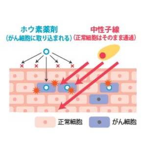 株式会社CICS（リゾートトラスト株式会社の連結子会社）、血管肉腫を対象としたBNCT（ホウ素中性子捕捉療法）の国内第II相臨床試験の主要評価に関する90日間の観察期間が完了