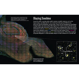 ナショナルジオグラフィック誌、アルツハイマー病の細胞死を調べるためのNanoStringの空間生物学技術を紹介